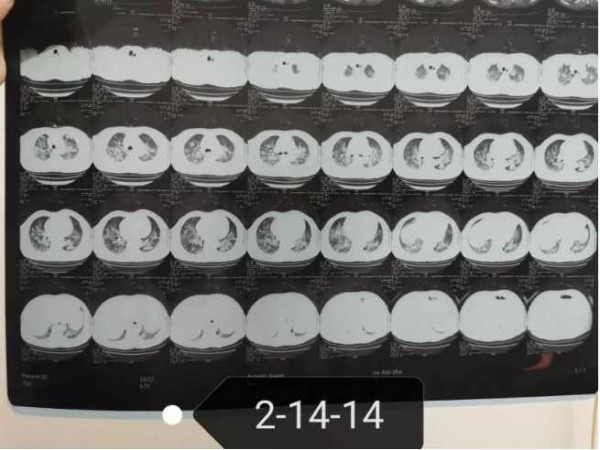 中医究竟效果如何？且看一位青年女中医抗击新冠肺炎纪实