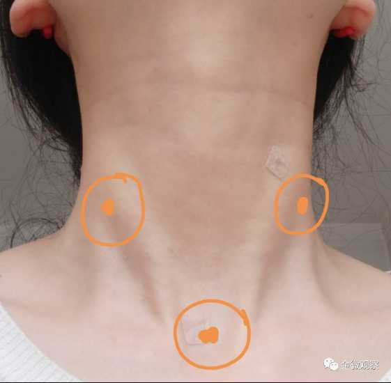 海外华人，请多一个自救选择｜一名医生对李跃华疗法的实践