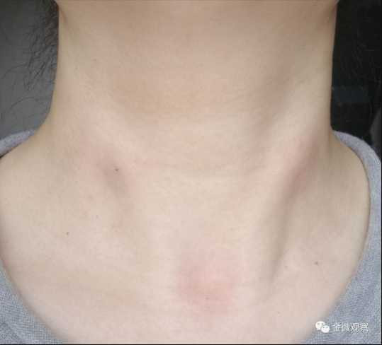 海外华人，请多一个自救选择｜一名医生对李跃华疗法的实践