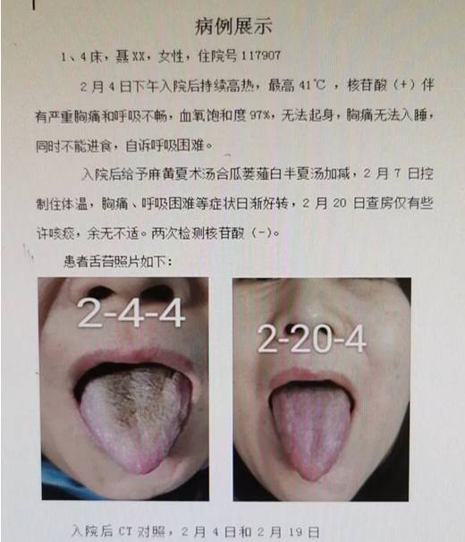 中医究竟效果如何？且看一位青年女中医抗击新冠肺炎纪实