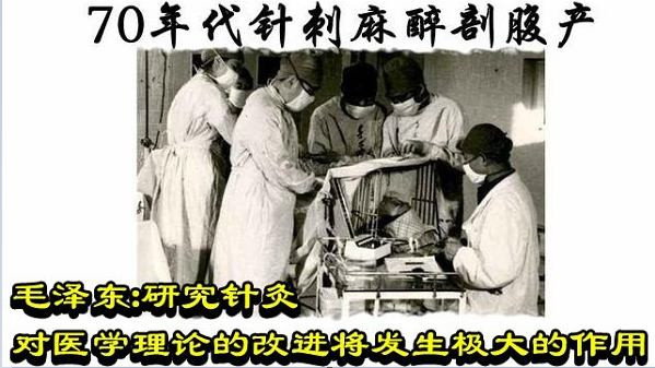 毛泽东：研究针灸对医学理论的改进将发生极大的作用