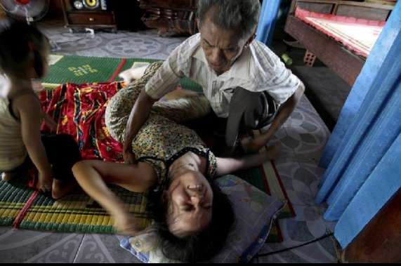 美军遗毒:“橙剂”阴影下的越南儿童