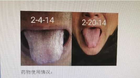 中医究竟效果如何？且看一位青年女中医抗击新冠肺炎纪实