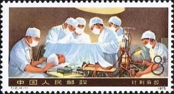 针刺麻醉，那段鲜为人知的历史
