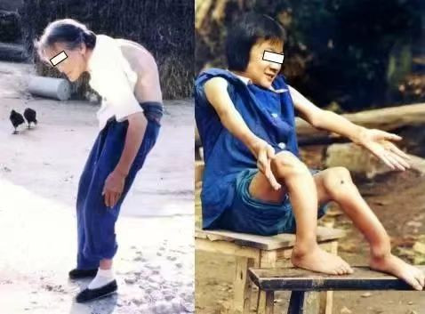 自来水加氟，是防龋，还是投毒？