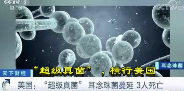 “超级真菌”，横行美国