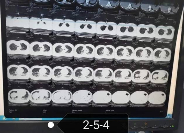 中医究竟效果如何？且看一位青年女中医抗击新冠肺炎纪实