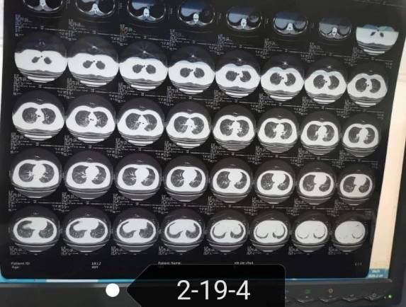 中医究竟效果如何？且看一位青年女中医抗击新冠肺炎纪实