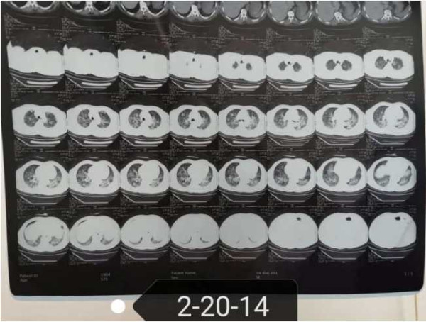 中医究竟效果如何？且看一位青年女中医抗击新冠肺炎纪实