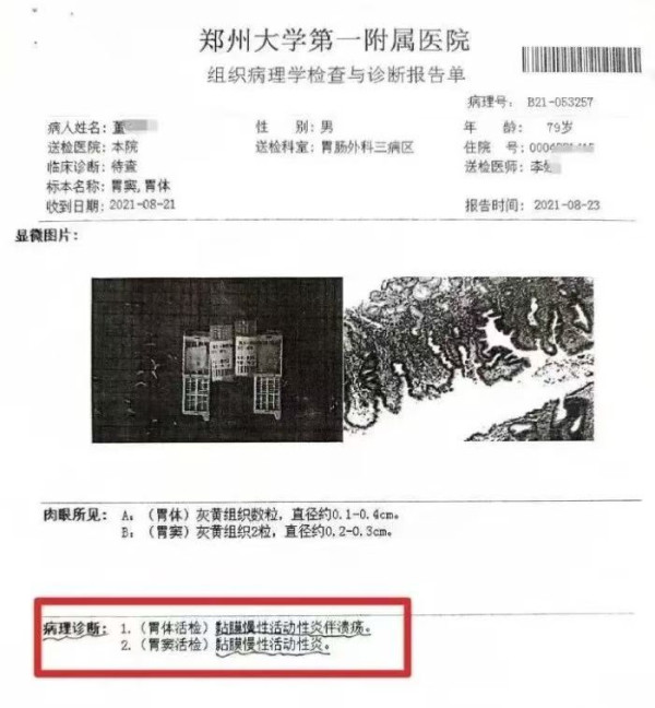 秦明|田春苗的预言依旧犀利：老人胃炎被当癌症切除全胃