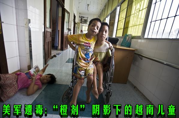 美军遗毒:“橙剂”阴影下的越南儿童