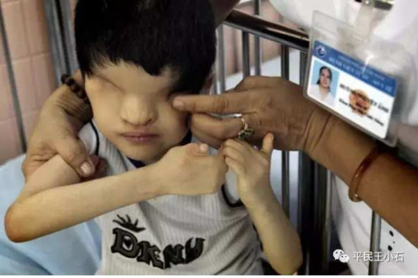 美军化武“橙剂”制造的人道灾难